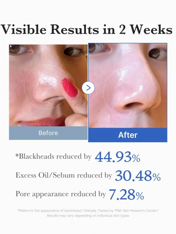 Medicube Zero Pore Pad 2.0 70τμχ – Απολεπιστικά Pads Προσώπου με AHA & BHA για Πόρους, Μαύρα Στίγματα & Λιπαρότητα
